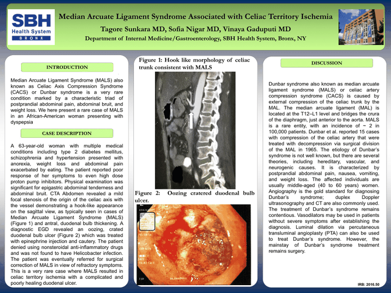 What is MALS An Introduction to Median Arcuate Ligament Syndrome