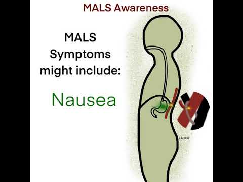 MALS Unveiling the Unknowns of this Syndrome