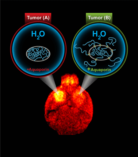 MRI Insights Visualizing MALS with Advanced Technology