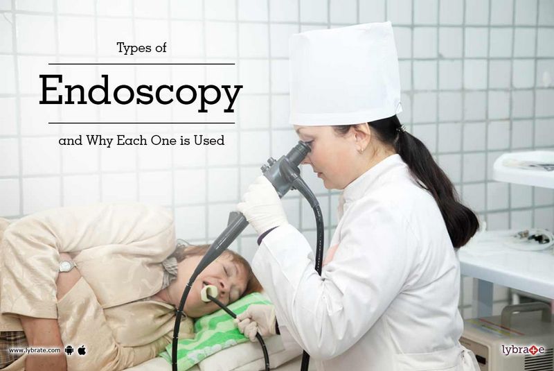 The Role of Endoscopy in Identifying MALS