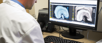 A gastroenterologist in the office examines the results of a gallbladder ultrasound of a patient with celiac disease